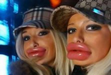 fatlips.jpg