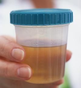 urine-cup.jpeg